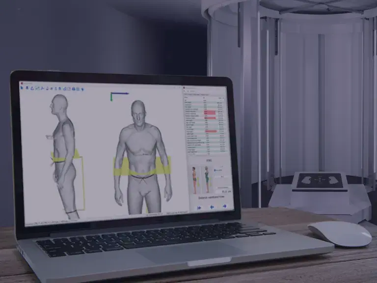 Anthroscan
